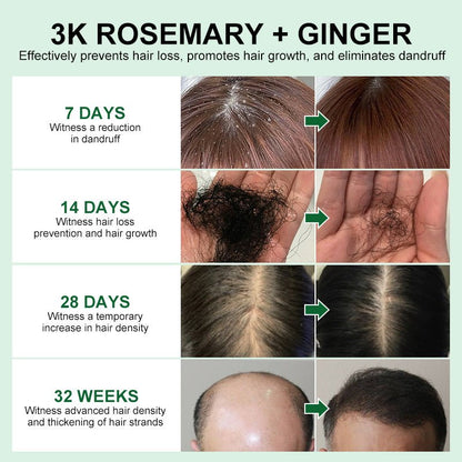 Rosemary Hair Growth Serum - NurseMade Naturals