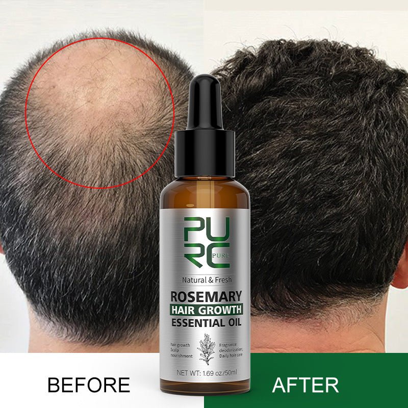 Rosemary Hair Growth Serum - NurseMade Naturals